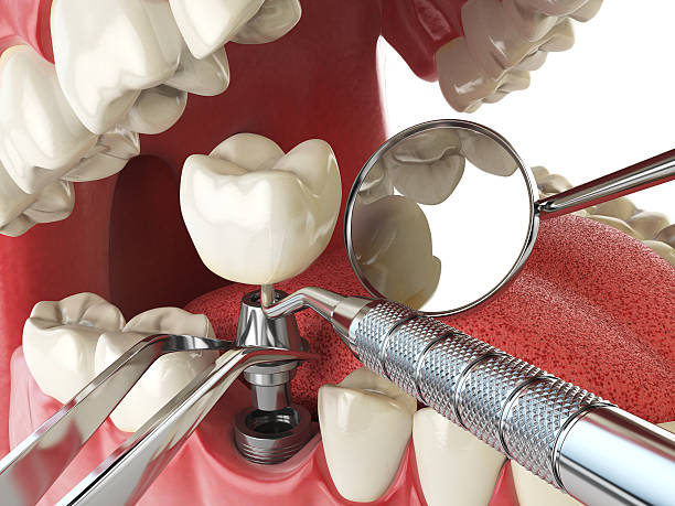Best Emergency Dental Services for Seniors in Columbia City, OR